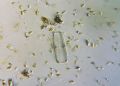 Pinnularia sp.